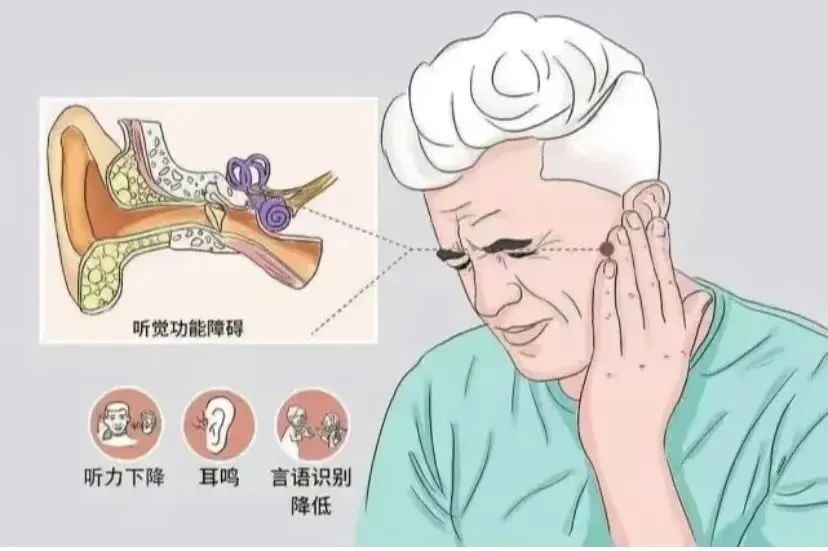 干細胞治療神經性耳聾患者，有效治療聽力甚至耳聾！